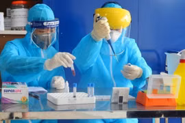 Экспресс-тест на вирус SARS-CoV-2 для людей. (Фото: ВИА).