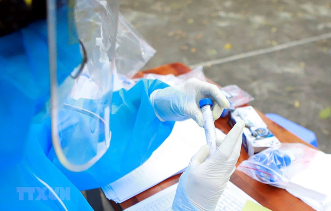 COVID-19 за 30 июня: 839 новых случаев заражения ảnh 1 COVID-19 за 30 июня: 839 новых случаев заражения ảnh 1