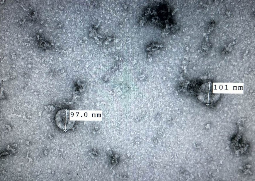 7 февраля 2020 года Национальный институт гигиены и эпидемиологии объявил об успешном культивировании и выделении нового штамма коронавируса (nCoV), вызывающего острые респираторные инфекции (COVID-19), что облегчило тестирование на вирус. Это предпосылка для исследования и разработки вакцин против этой болезни. (Источник: опубликовано ВИА) 