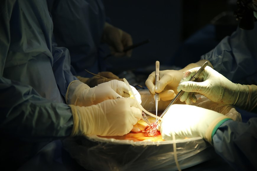 Второй пациент - 42-летний мужчина, ранее перенесший 5 операций на брюшной полости из-за перитонита и перфорации кишечника, в том числе одну операцию по удалению большей части тонкой кишки в мае 2007 года. Осталось около 80 см кишечника. В мае этого года он лечился в больнице по поводу необратимой кишечной недостаточности из-за SBS 1-го типа и толстой кишки. Ему сделали операцию через день после первого пациента. Его брат стал донором. Оба донора находятся в стабильном состоянии, а реципиенты, чьи показатели выживаемости стабильны, находятся под тщательным наблюдением. На сегодняшний день в мире выполнено около 1.000 таких трансплантаций. Впервые во Вьетнаме были успешно проведены две операции по пересадке кишечника, благодаря чему Вьетнам стал 20-й страной в мире, которая может выполнять столь сложные операции на внутренних органах. (Фото: Vietnam+)