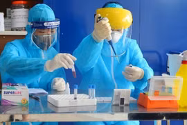 Медицинские работники проверяют образцы на новый коронавирус SARS-CoV-2 (Фото: ВИА)