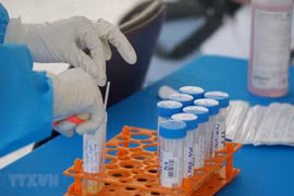 Взятие образцов для тестирования на SARS-CoV-2 (Фото: ВИА)