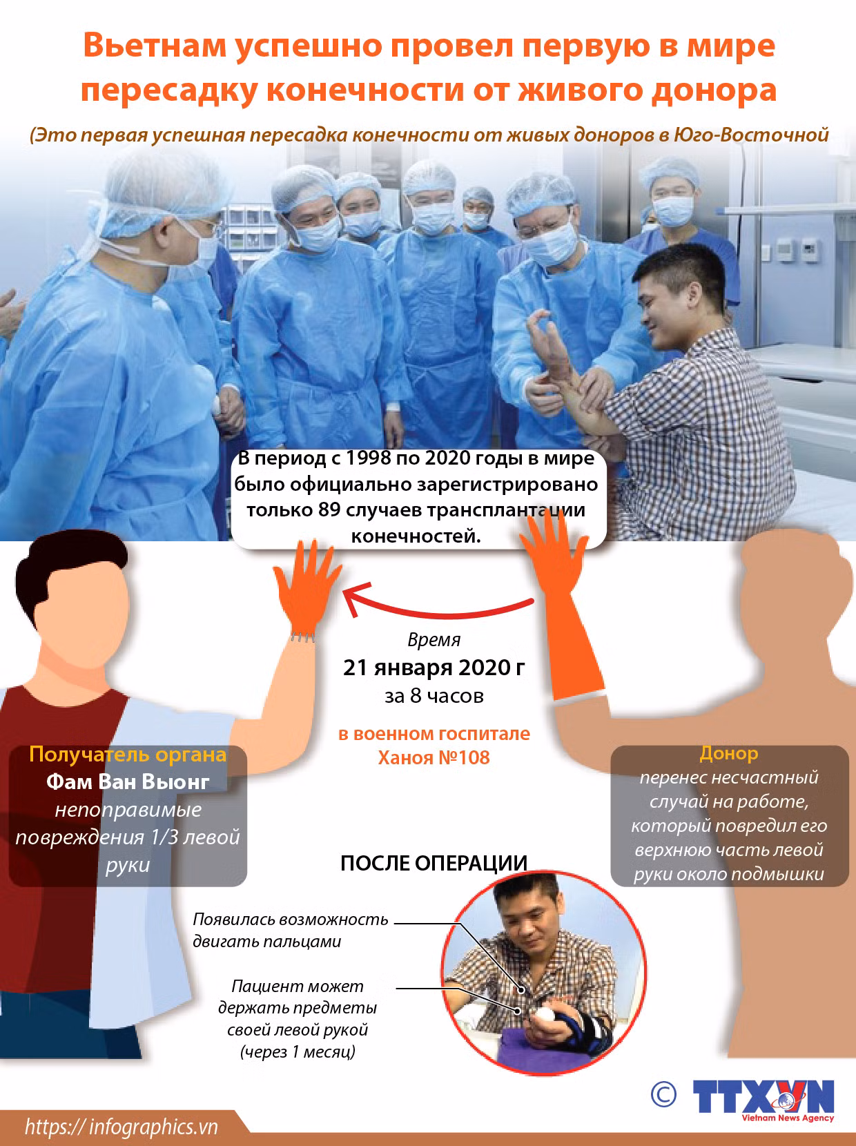 Вьетнам успешно провел первую в мире пересадку конечности от живого донора ảnh 1