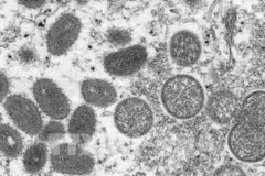 Микроскопическое изображение вируса оспы обезьян, опубликованное Центрами США по контролю и профилактике заболеваний. (Фото: AP/ВИА) 