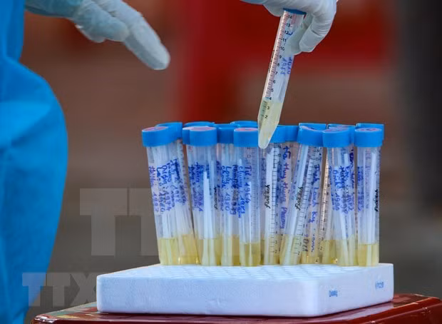 Сообщается еще о двух погибших от COVID-19, число погибших достигло 13 ảnh 1 Сообщается еще о двух погибших от COVID-19, число погибших достигло 13 ảnh 1