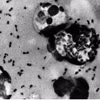Бактерия Yersinia pestis — возбудитель чумы, наиболее распространенной формой которой является бубонная чума; обычно передается через укусы инфицированных блох (Фото: Центр по контролю и профилактике заболеваний США)