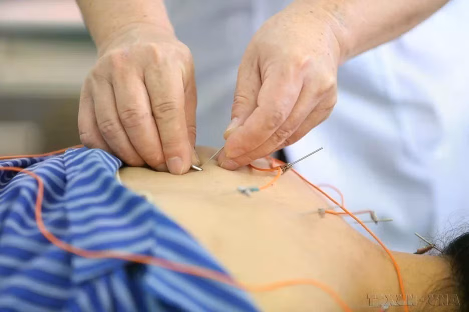 В провинциальной больнице традиционной медицины Лангшон для лечения пациентов используется метод электроакупунктуры. (Фото: ВИА)