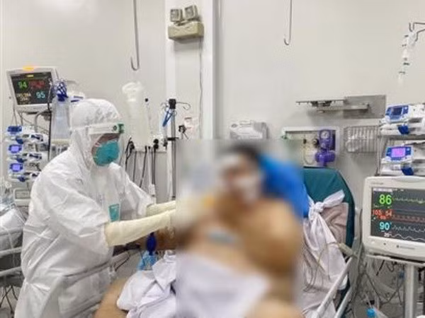 Повышение возможности экстренной и активной реанимации для лечения тяжелых пациентов с COVID-19 ảnh 1 Повышение возможности экстренной и активной реанимации для лечения тяжелых пациентов с COVID-19 ảnh 1