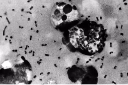 Бактерия Yersinia pestis — возбудитель чумы, наиболее распространенной формой которой является бубонная чума; обычно передается через укусы инфицированных блох (Фото: Центр по контролю и профилактике заболеваний США)