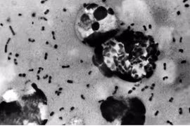 Бактерия Yersinia pestis — возбудитель чумы, наиболее распространенной формой которой является бубонная чума; обычно передается через укусы инфицированных блох (Фото: Центр по контролю и профилактике заболеваний США)